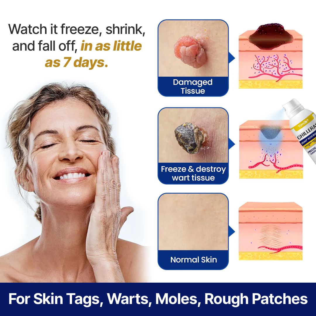 ChillErase® Bump Renewal Spray